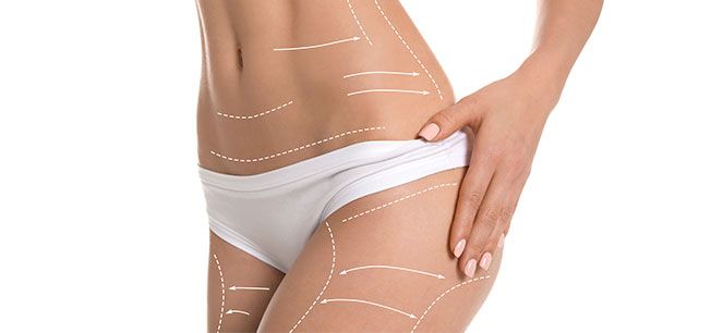 Lipo corporal